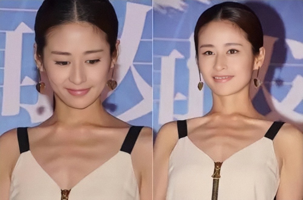 "皮包骨"明星好尴尬,"干瘪"到撑不起衣服,谁的审美有问题?