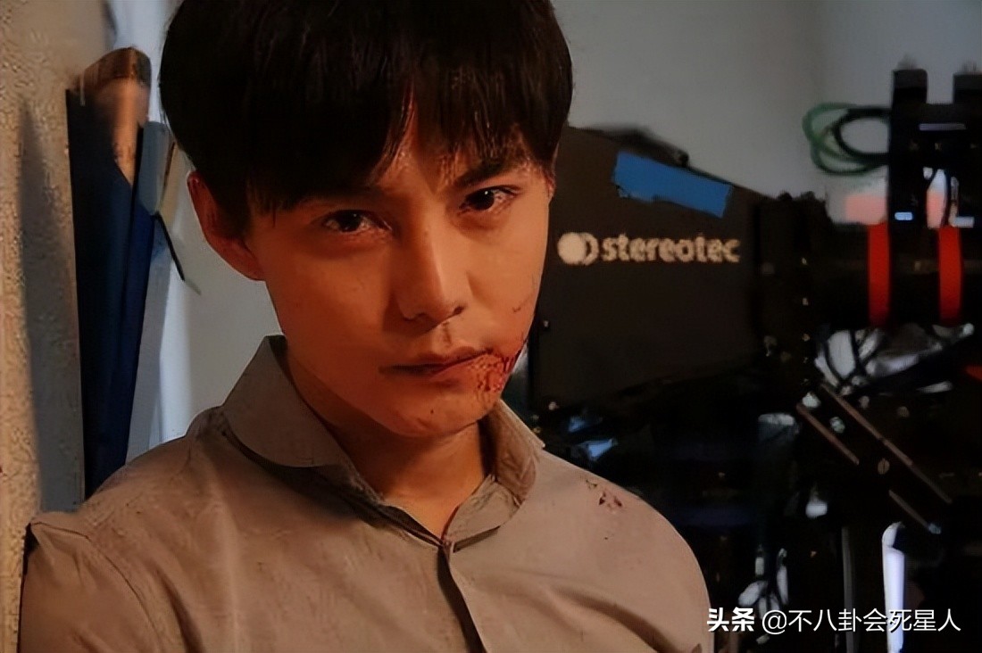 内娱新晋“发面馒头”，肿胀僵硬没眼看，让动脸前辈们自愧不如