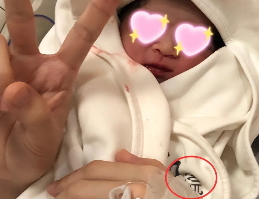 张碧晨太惨了，偷偷给顶流生孩子，没名没份还被网暴