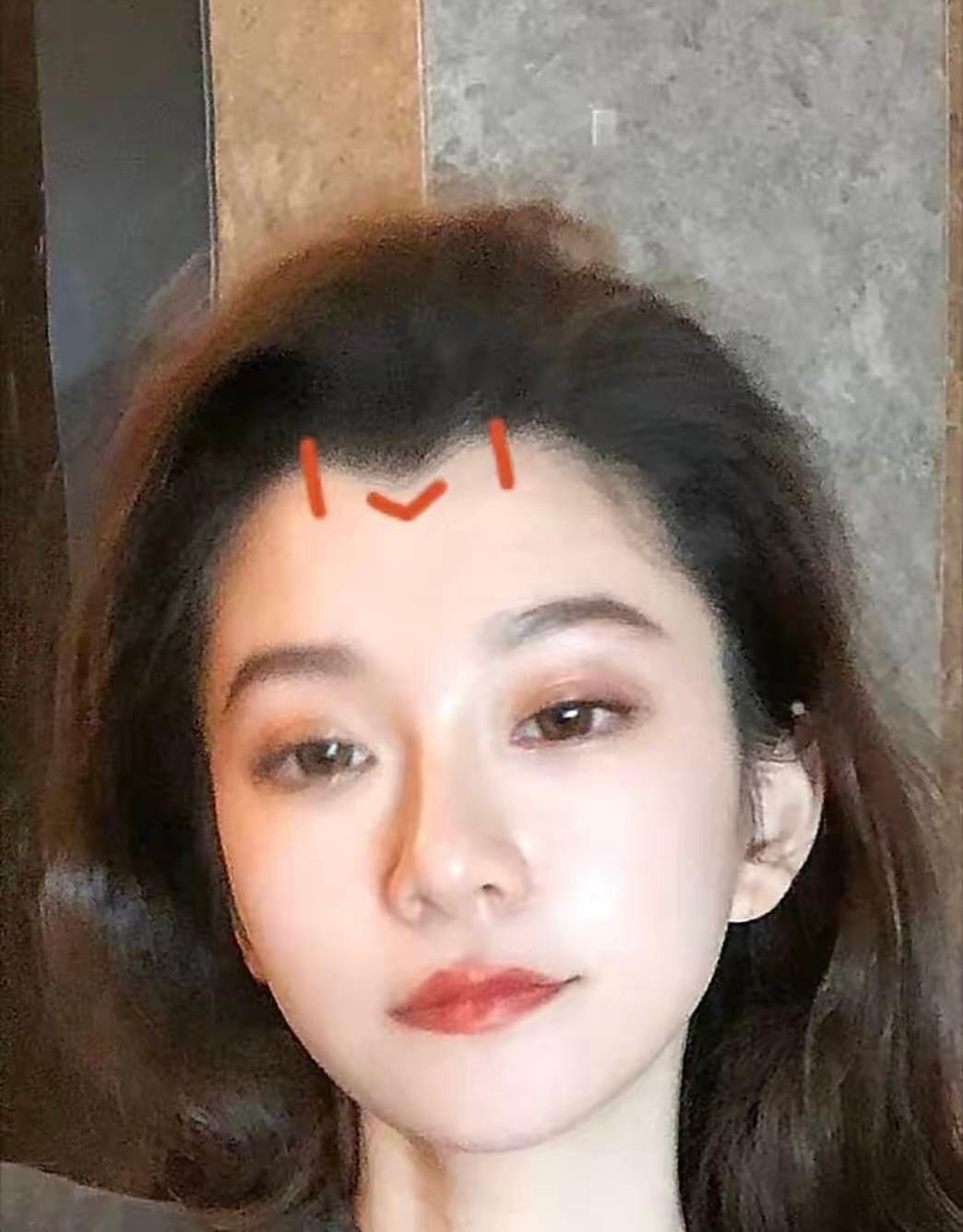 四,美人尖发际线
