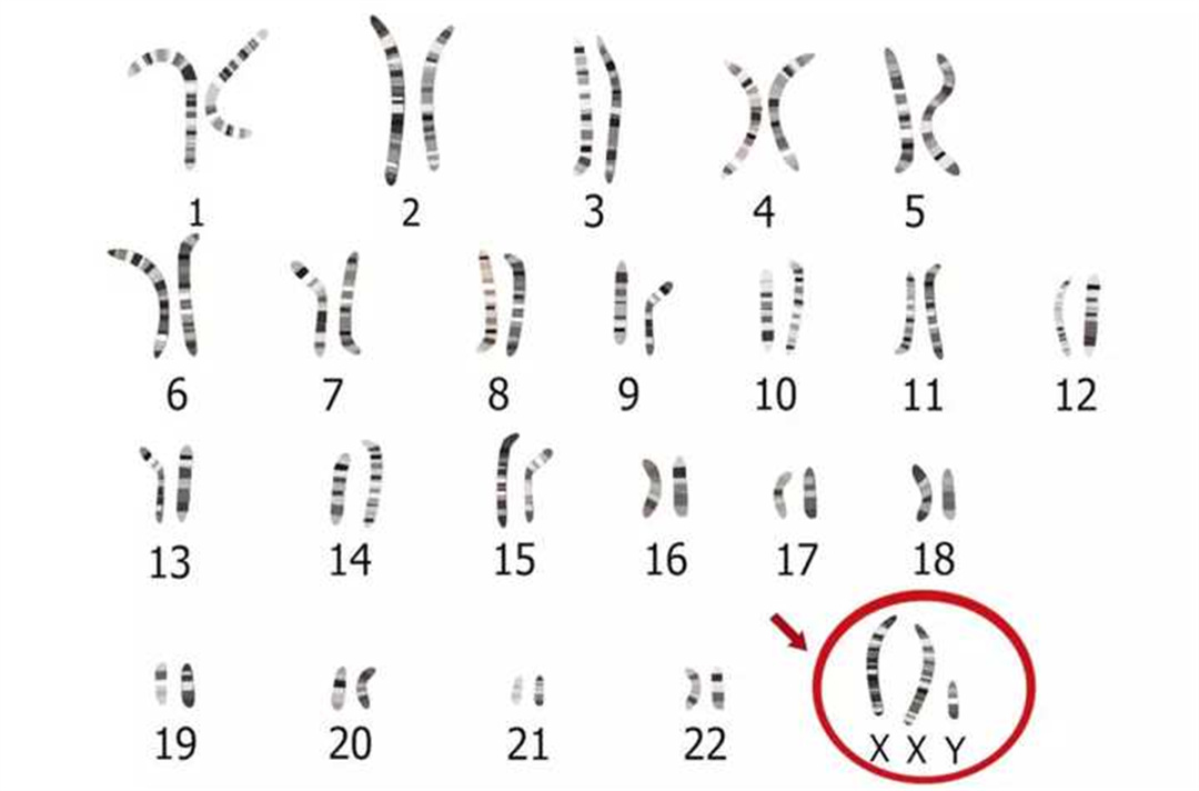 人体二十三对染色体图图片