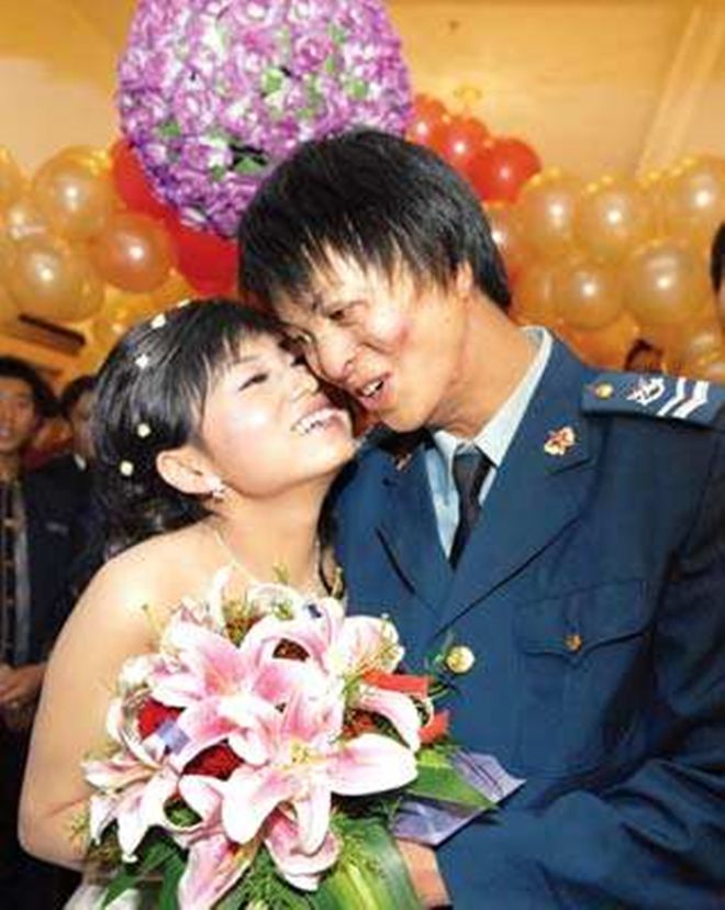 21岁战士救火毁容，女白领不顾反对嫁他，结婚时市长和首长都来了