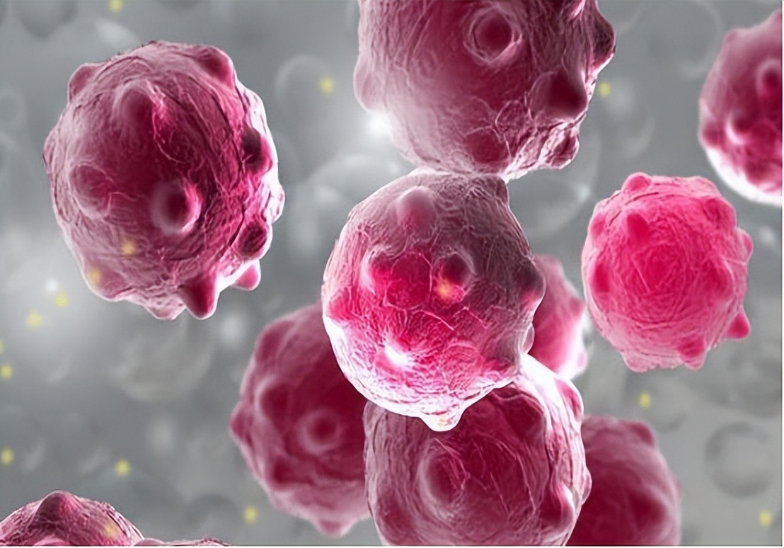 别把喉癌当成咽炎，若颈部有3种表现建议引起重视，别后知后觉