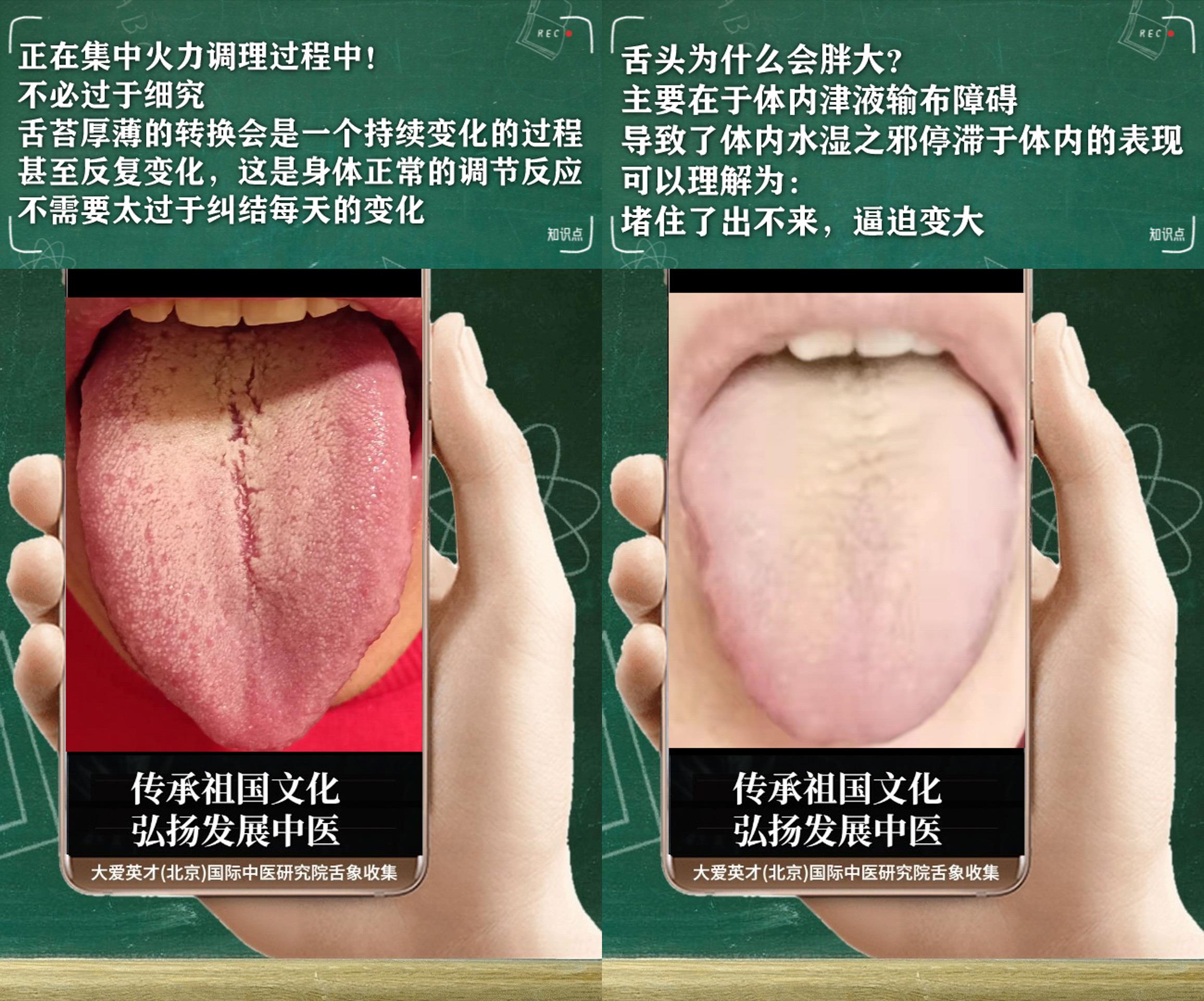 中医分析：憋屈、手足冰凉、鼻塞不通、反反复复很烦躁