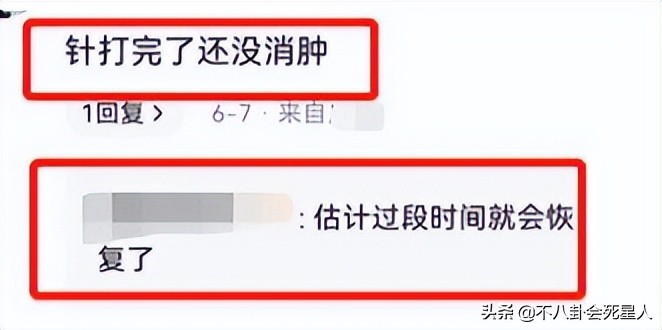 内娱新晋“发面馒头”，肿胀僵硬没眼看，让动脸前辈们自愧不如