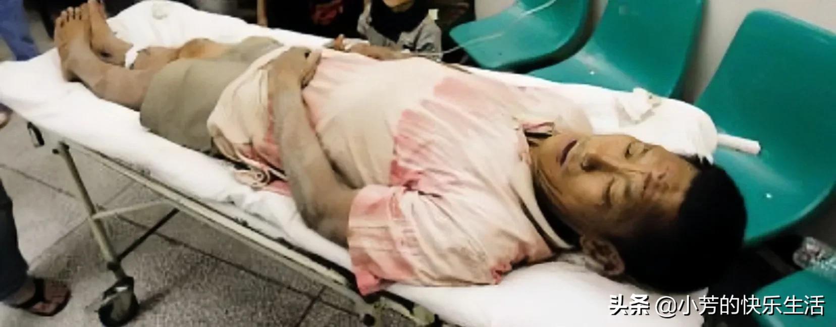 山东16岁女孩3度卖血养活继父一家7口，惨死后3个哥哥披麻戴孝