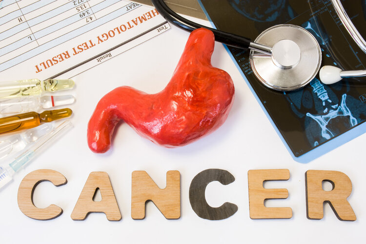 35岁查出胃癌晚期，提醒：别把癌症当“胃炎”，5个症状要搞清楚