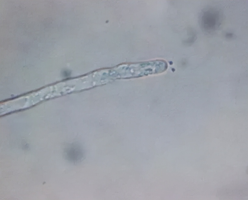 一文揭示，水产养殖中水霉菌繁殖和侵染过程