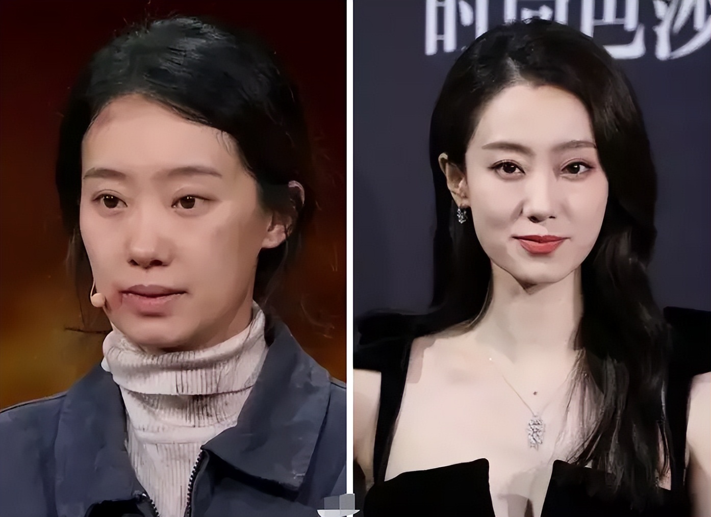鼻子塌不可怕，面中凹才拉胯，显苦显凶还显老，许多女星深受其害