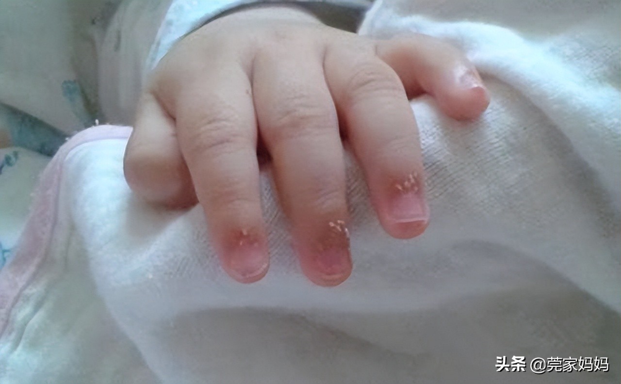 新生儿手指甲什么时候剪-菠萝孕育
