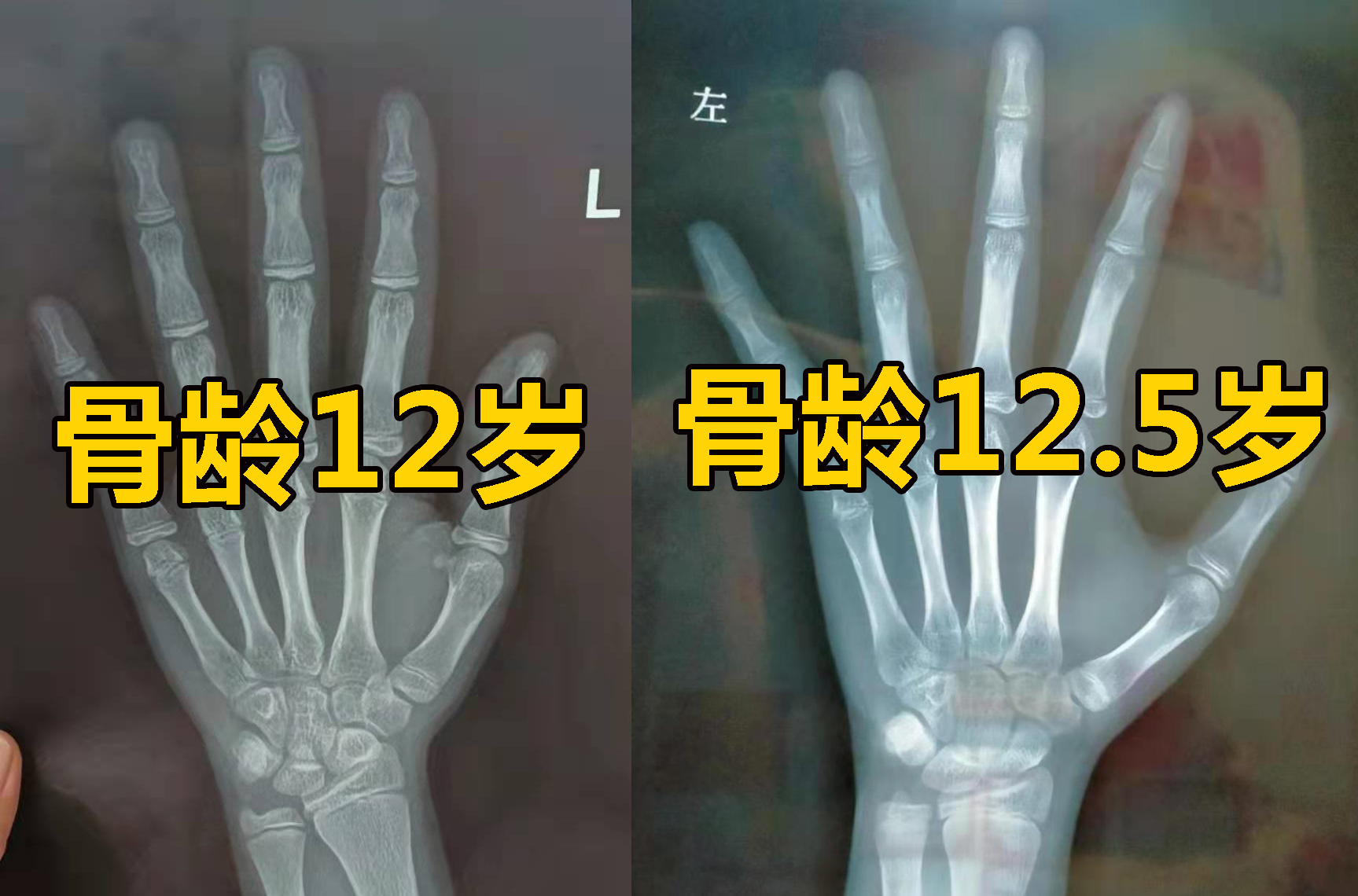 做好4点,能长更多更高