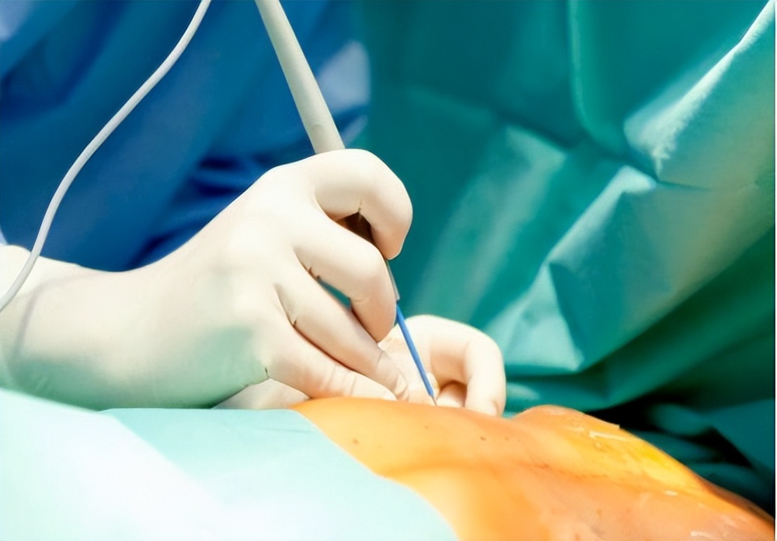 别把喉癌当成咽炎，若颈部有3种表现建议引起重视，别后知后觉