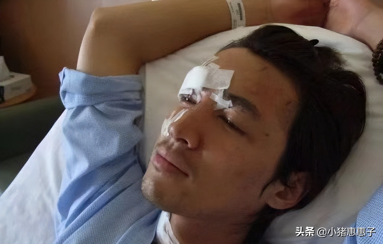 比杨幂眼角受伤更惨烈8位明星：烧伤、毁容、中弹、瘫痪、丧命