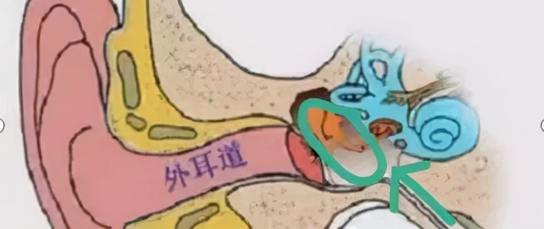 孩子耳朵痛，要警惕什么？不只是中耳炎，这样做孩子少遭罪