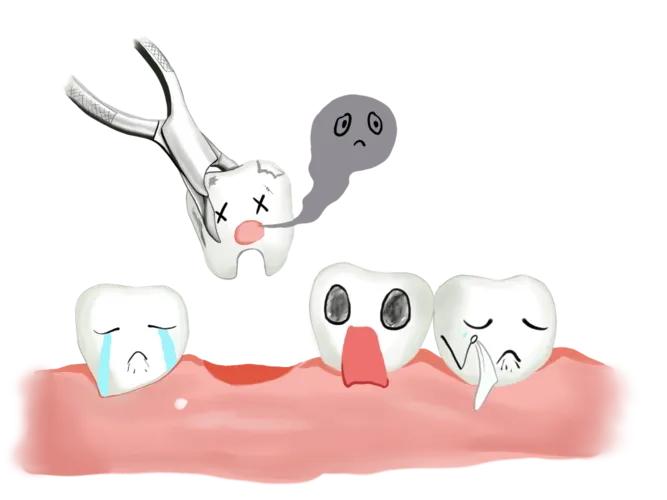 生活趣事:去医院补牙,医生劝我拔智齿