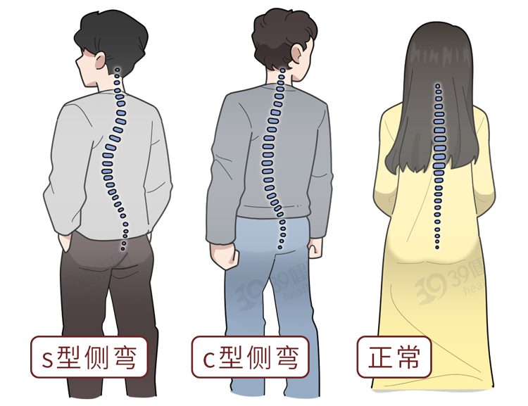 别再只是「把背挺直」了！正确的坐姿是这样的，很多人还不知道