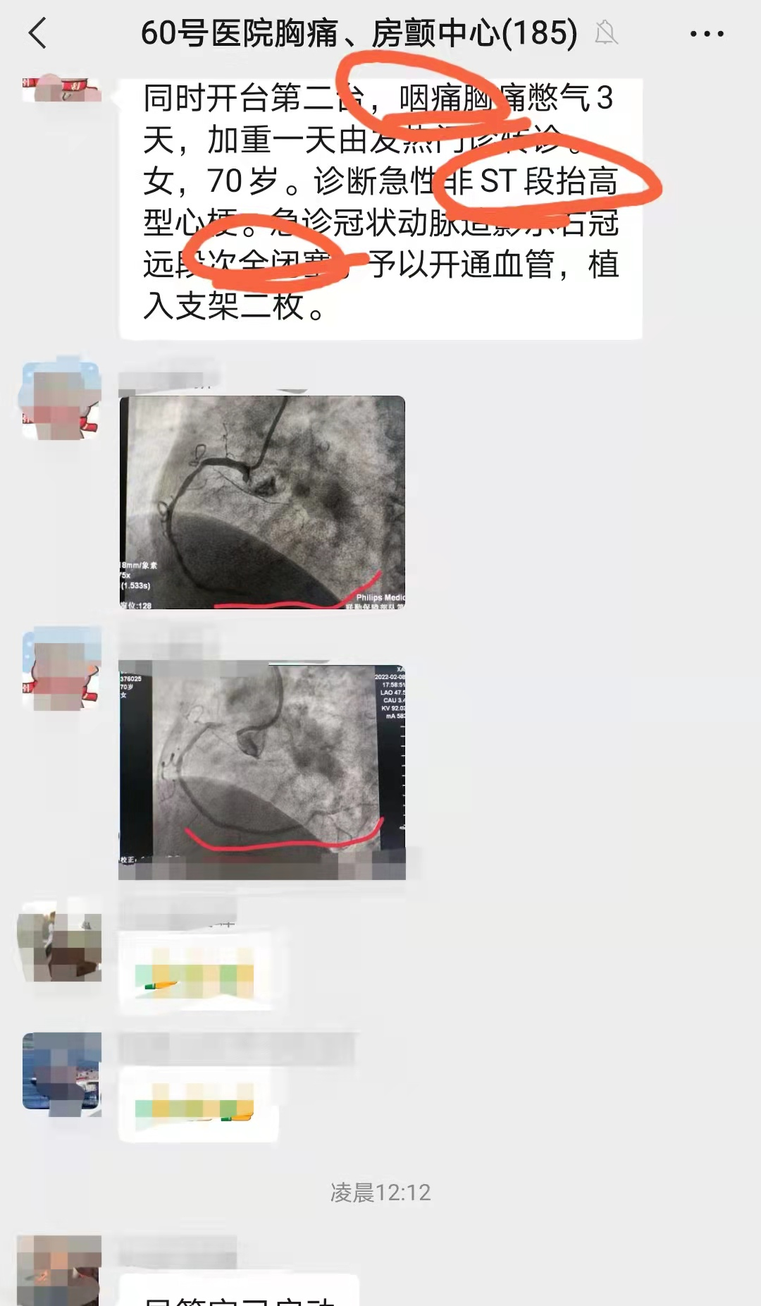 连续抢救2位心梗：1个咽痛1个腹痛！如何识别这些不典型的心梗？