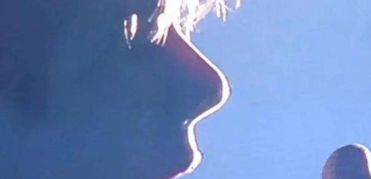 演艺圈“花式鼻子”大比拼，又尖又翘又吓人，一个比一个精彩