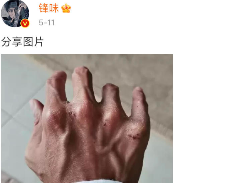 这6位男星，因拍戏差点命不保，一个比一个的“后遗症”严重