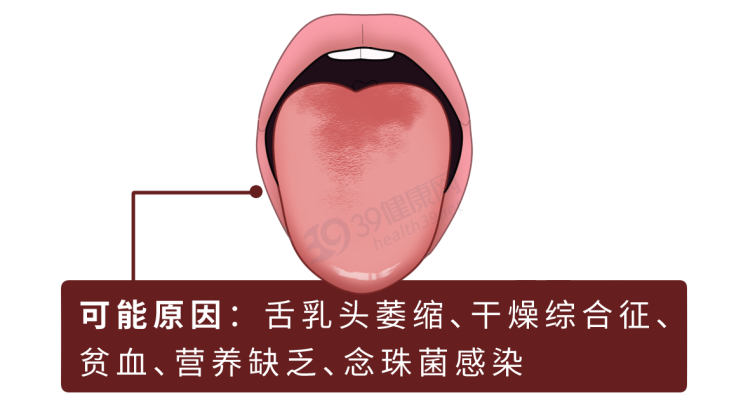 体内有疾，舌头先知？提醒：舌头出现这些变化，可能是生病了