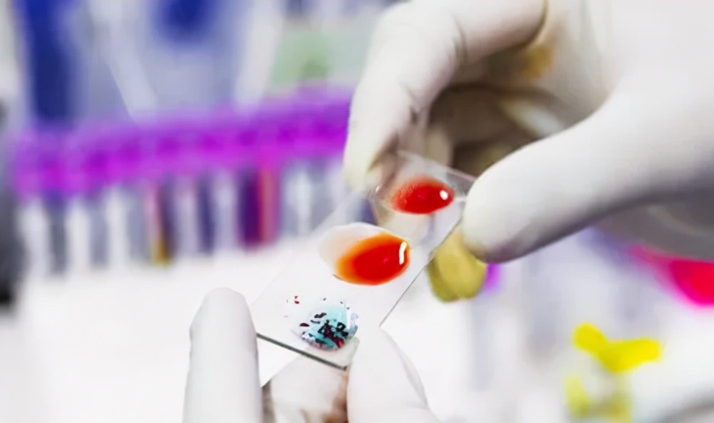 一个人的血型可以决定癌症吗？25年的研究发现：可能更安全的血型