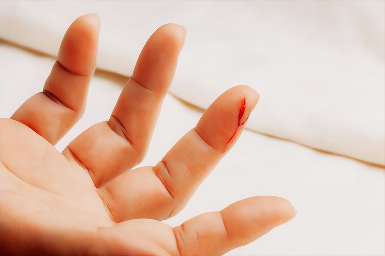 手術時，為啥切開皮膚幾乎不出血，生活中稍微劃破就會流血呢？