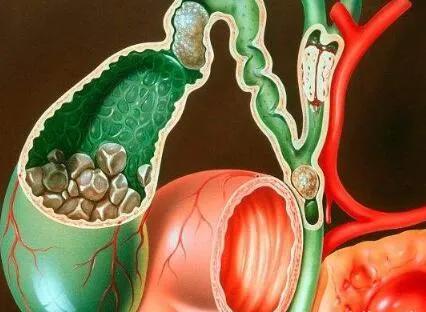 体检查出这19种疾病，医生：其实根本不用治！别再花冤枉钱