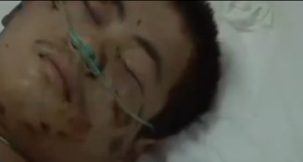 武汉男子从18层楼坠落，不仅没死还行为怪异，医生表示难以置信