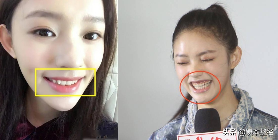 林允颜值变化史：高美商逆袭，堪称隐藏的骨相王者