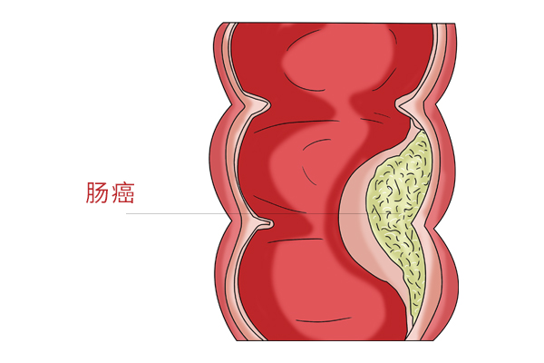 44岁患癌，活了100岁！百岁老人也会生病但就是长寿，秘诀是啥？