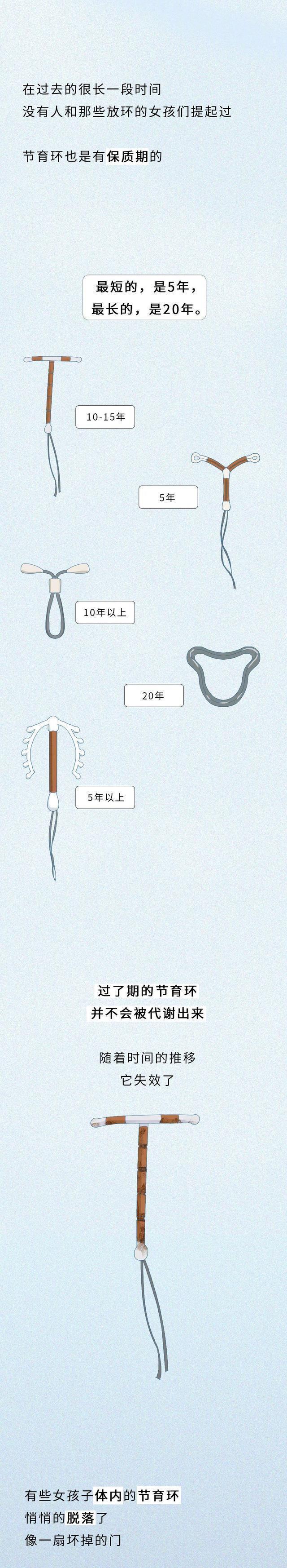 “节育环”长时间在女人体内，会发生什么变化？