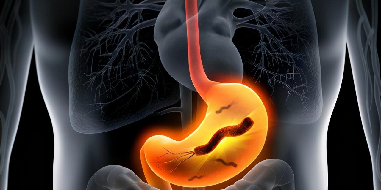 体检查出“幽门螺杆菌”，吃了两周药，再复查还是阳性，咋回事？