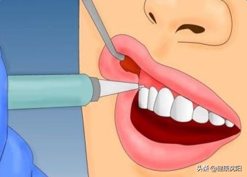 [健康知识普及行动] 口腔预防保健篇之专家和您聊聊牙周病相关事