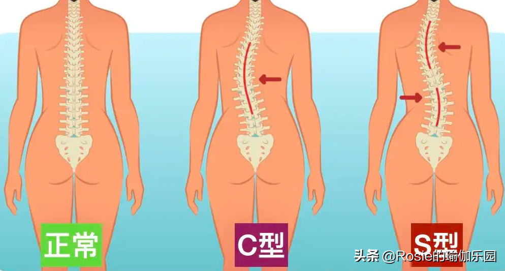 大S晒照美肩状态好，脊柱侧弯直角肩也不美，这样2步解锁好体态