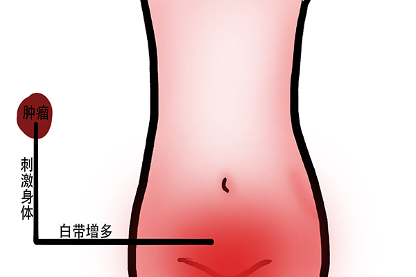 为什么很多患者拒绝做肿瘤穿刺活检？虽然有风险，但意义重大