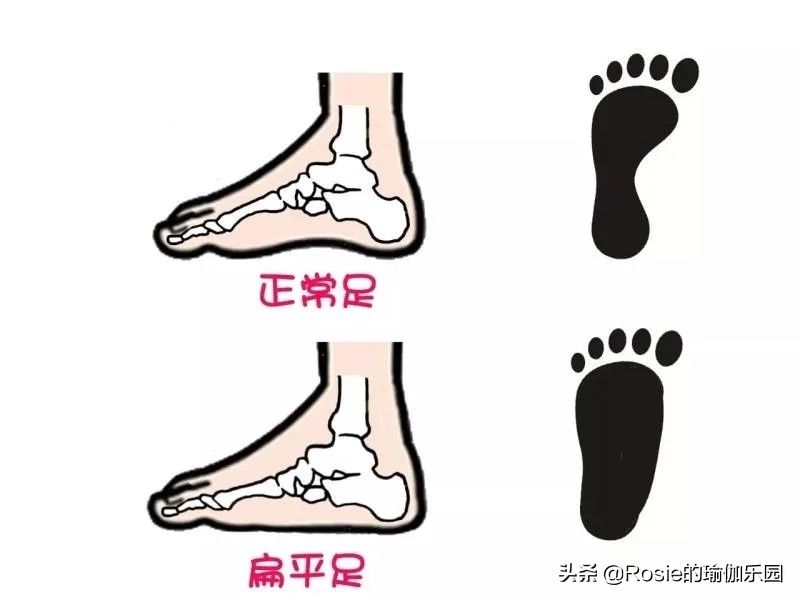 脚踝粗不自信，4步带你瘦腿瘦小脚踝，像阿雅一样自信成女王