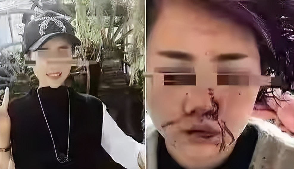 “唐山”被打女子伤情曝光，歹徒量刑或加重，“黑伞”也保不住他