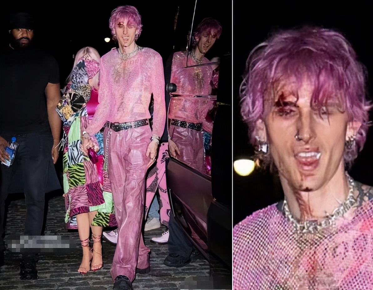 知名歌手枪爷表演太疯狂！直接用酒瓶砸脑袋，一边流血一边唱歌