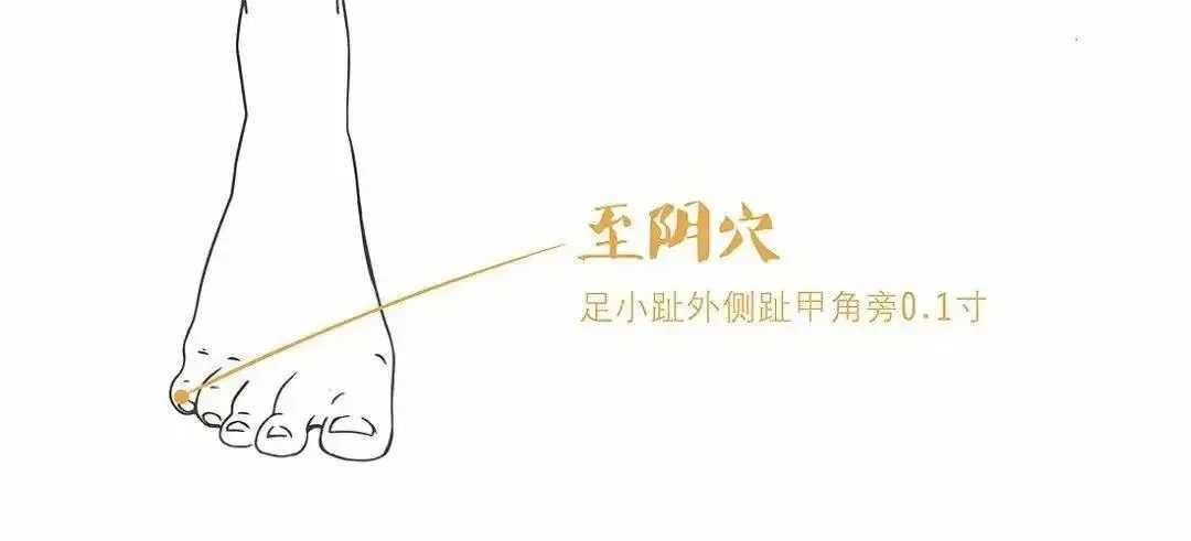 胎位不正，艾灸可以吗？