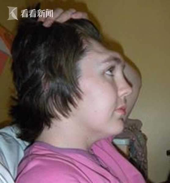 可怕，英女子坐副驾翘脚，安全气囊以200km/h爆开，股骨插进屁股