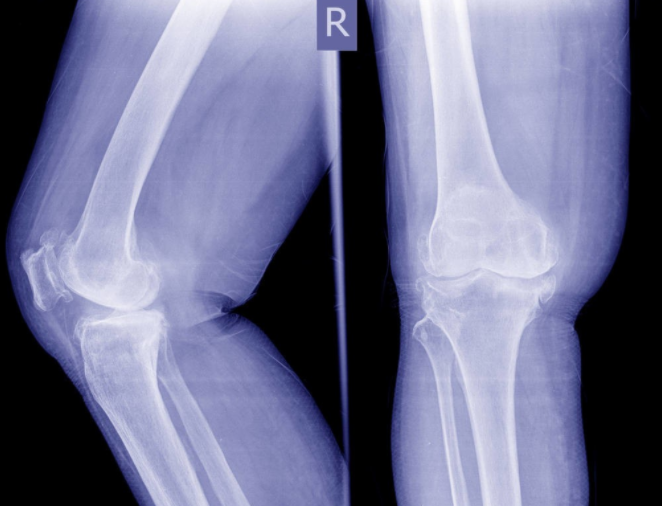 老年人常常下肢无力？可能是这5个原因导致的，医生教您如何应对