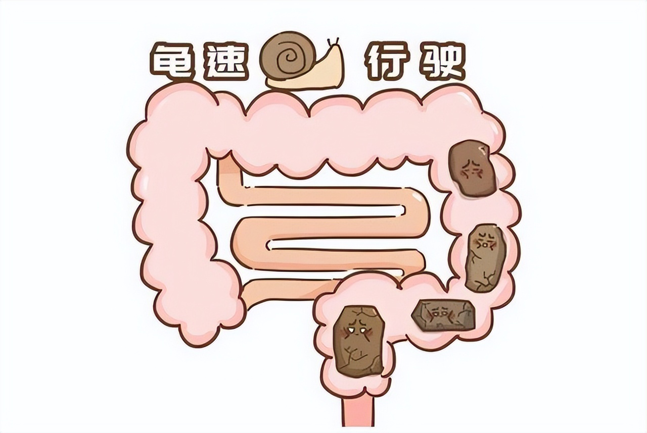 肠道的“推粪器”，香蕉不在其中，每天坚持吃，帮你缓解便秘困扰