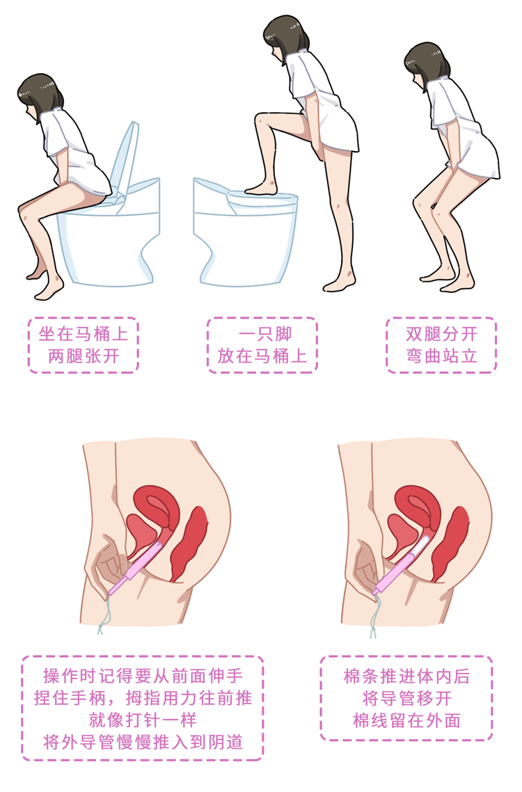 卫生棉条怎么用步骤图解（塞卫生棉条正确姿势示范）