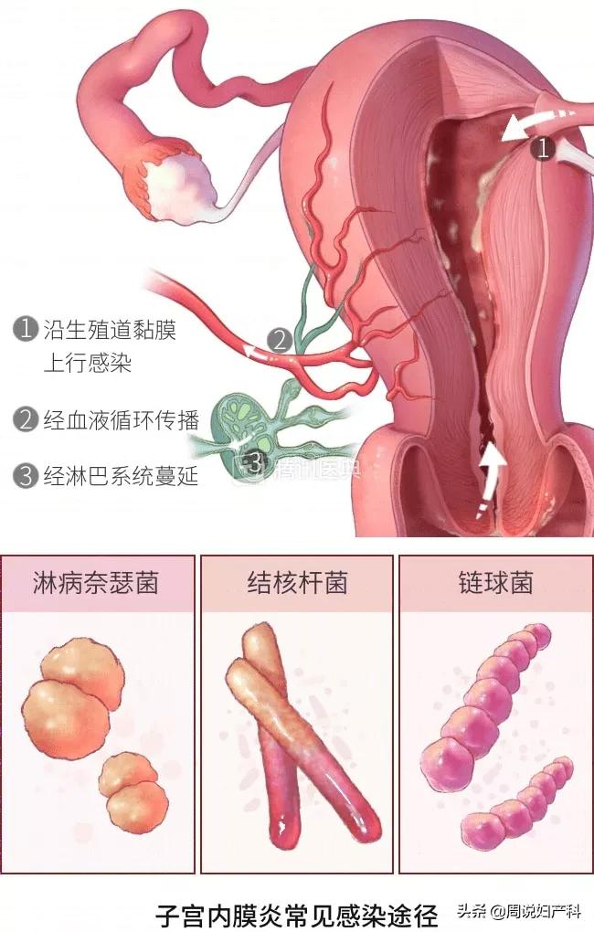 月经量少，真的会影响怀孕吗？这1种情况要当心