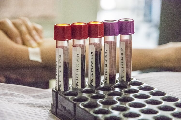 为啥一去医院看病就抽血？每天抽那么多血，最终都去哪儿了？