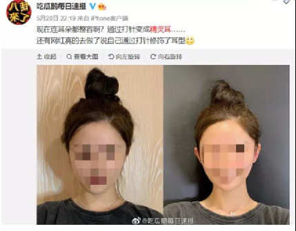 那些为变美而付出的代价