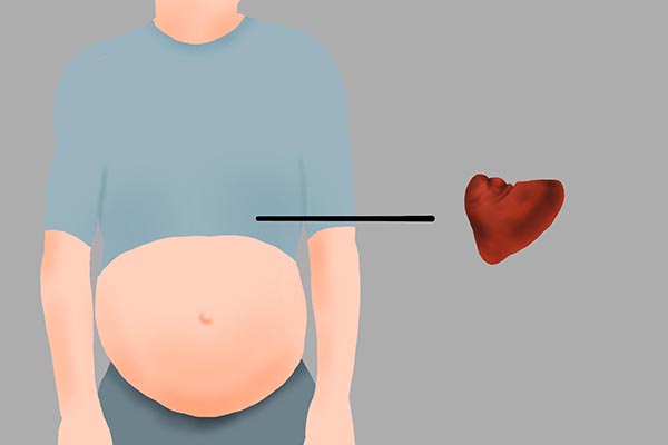总是头晕、心慌、乏力，是贫血了吗？有3种贫血类型，中医教你治