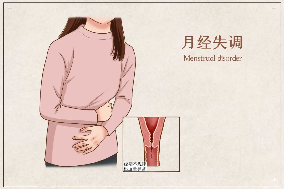 月经来潮的前3天起,可以选用以下药物中的任何一种使经期推迟1口服