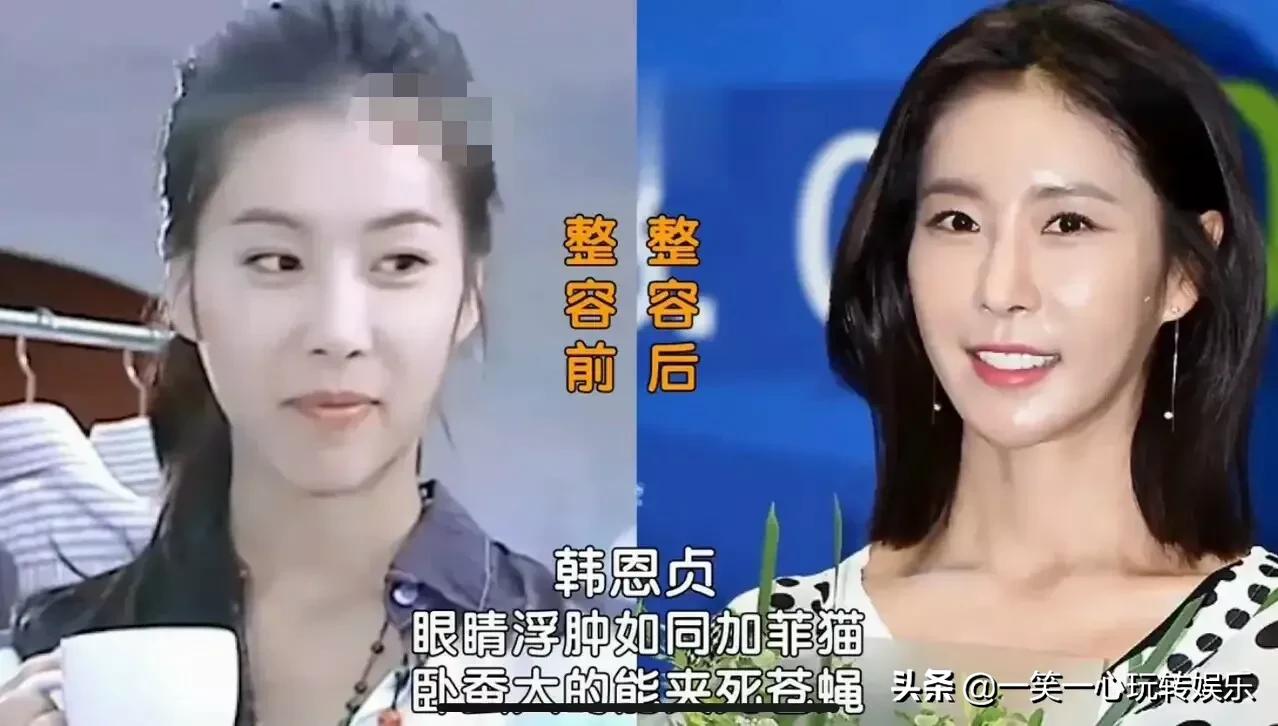 韩国明星变美“后遗症”，朴春360度崩盘，李多海变僵尸脸