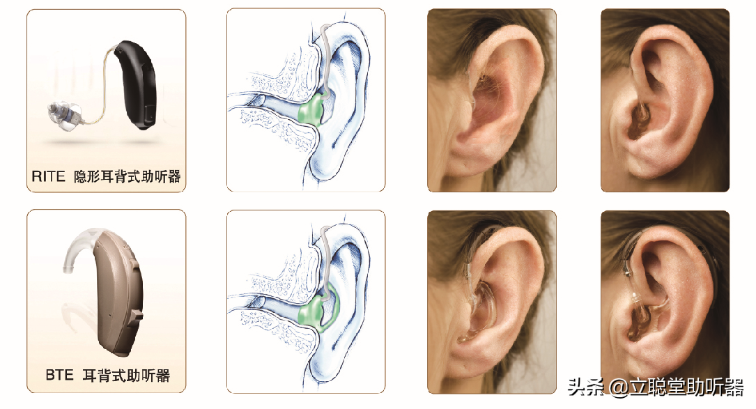 老人怎么选助听器？哪个牌子助听器适合老人，好用耐用质量好
